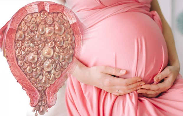 अंगूर गर्भावस्था क्या है, अंगूर गर्भावस्था के लक्षण