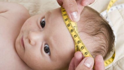 शिशुओं में सिर की परिधि को कैसे मापें? शिशुओं में सिर की ऐंठन को कैसे ठीक करें?