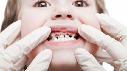 सेमेस्टर के दौरान अपने बच्चे की दंत चिकित्सा देखभाल करवाएं!