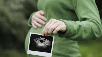 शिशु का लिंग सबसे पहले और निश्चित कब है? लिंग का निर्धारण कौन करता है?