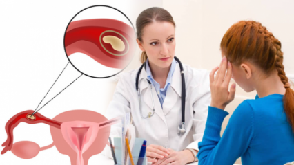 अस्थानिक गर्भावस्था (एक्टोबिक गर्भावस्था) क्या है, क्यों? अस्थानिक गर्भावस्था के संकेत क्या हैं?