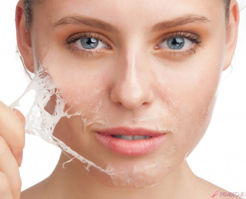 त्वचा छीलने के लिए क्या अच्छा है और त्वचा छीलने कैसे है? त्वचा छीलने का घरेलू उपाय
