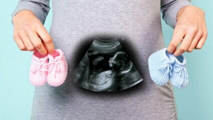 क्या गर्भावस्था के पहले तिमाही में बच्चे का लिंग निर्धारित किया जाएगा?
