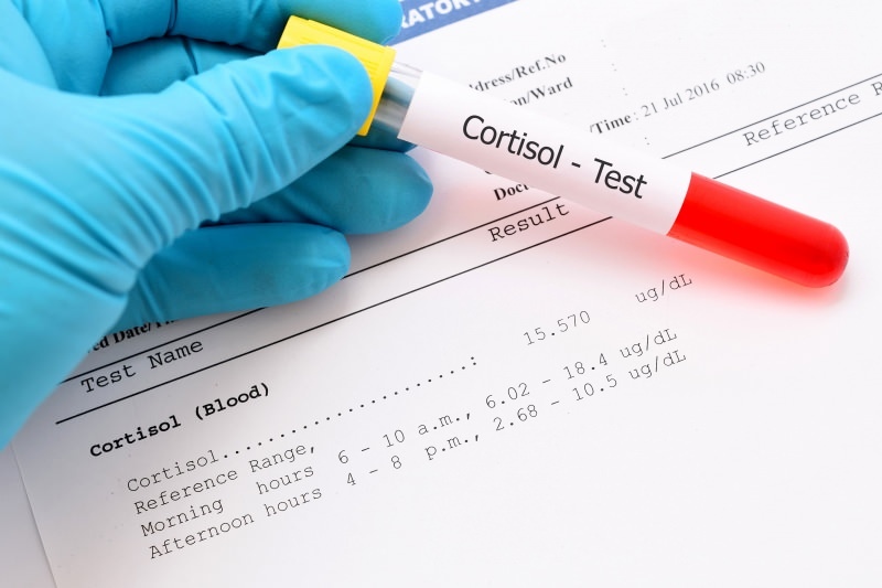 कोर्टिसोल का स्तर रक्त परीक्षणों में होता है