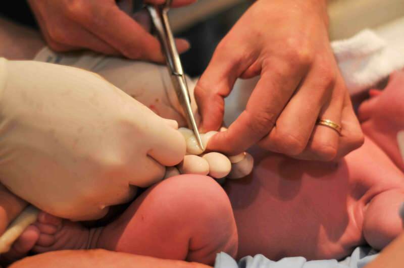 शिशुओं में गर्भनाल को कब काटा जाना चाहिए?