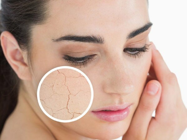 त्वचा क्यों सूख जाती है? शुष्क त्वचा पर क्या करें? शुष्क त्वचा के लिए सबसे प्रभावी देखभाल सिफारिशें हैं