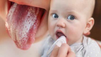 शिशुओं में थ्रश के लक्षण और उपचार! शिशुओं में थ्रश कैसे पारित किया जाता है? सटीक उपाय ...