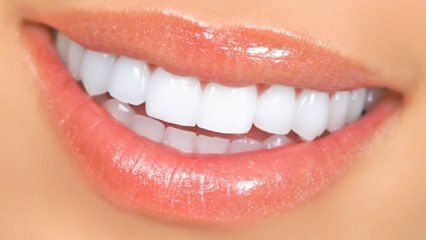 प्राकृतिक दांत सफेद करने के तरीके