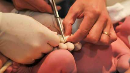 शिशुओं में गर्भनाल कब काटी जाती है? गर्भनाल को देर से काटने के फायदे