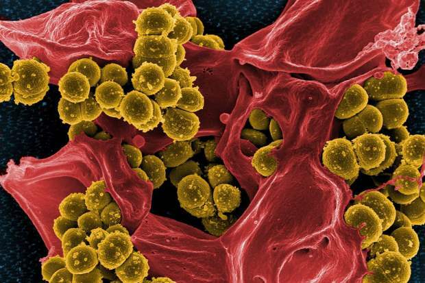 mers वायरस सार्वजनिक क्षेत्रों में तेजी से फैलता है