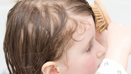 बच्चों में डैंड्रफ का बाल उपचार
