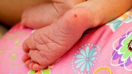 शिशुओं में एड़ी का रक्त क्यों लिया जाता है? शिशुओं में एड़ी रक्त परीक्षण के लिए आवश्यकताएँ
