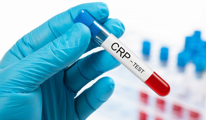 रक्त में सीआरपी क्यों बढ़ता है? CRP क्या है? सीआरपी कैसे कम करें?