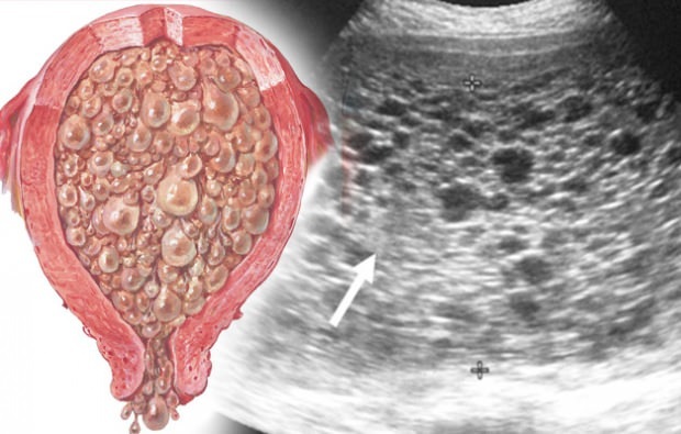अंगूर गर्भावस्था के लक्षण क्या हैं अंगूर गर्भावस्था