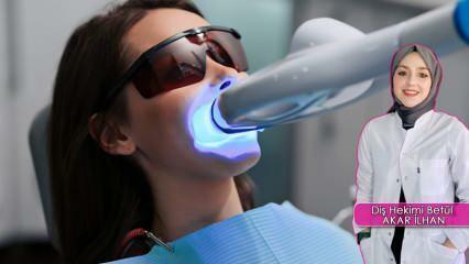 दांत सफेद करने (ब्लीचिंग) विधि कैसे की जाती है? क्या ब्लीचिंग विधि से दांतों को नुकसान होता है?