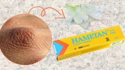 Hametan क्रीम क्या करती है? Hametan क्रीम घरेलू उपयोग! हेमटन मतभेद