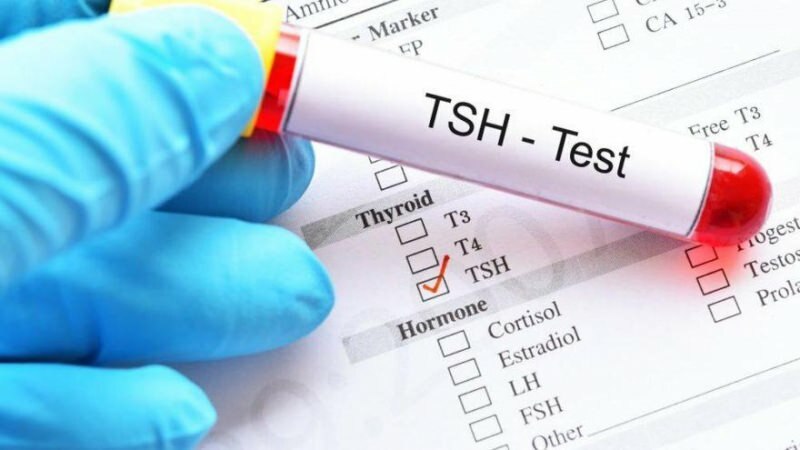 tsh टेस्ट एक हार्मोन टेस्ट है