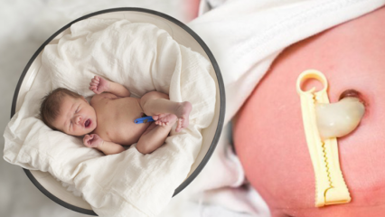 प्लेसेंटा प्रेविया क्या है? शिशुओं में गर्भनाल की देखभाल कैसे करें? यदि गर्भनाल लम्बी है ...