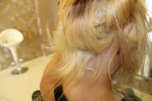 बीच से जलते बालों का क्या किया जाता है? उपचारित बालों को कैसे बनाए रखा जाना चाहिए?