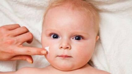 शिशुओं के लिए त्वचा की देखभाल युक्तियाँ! शिशुओं में त्वचा की समस्याएं क्या हैं?