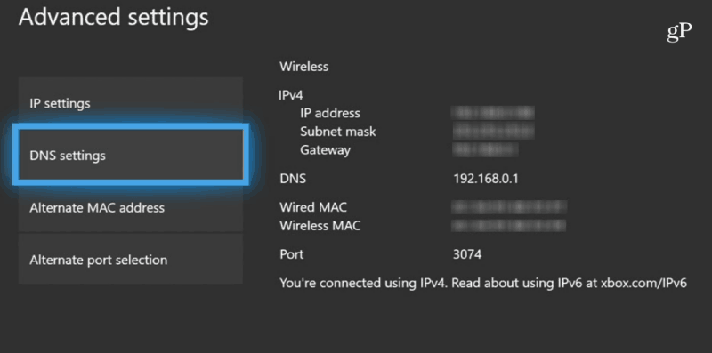 Xbox एक DNS सेटिंग्स