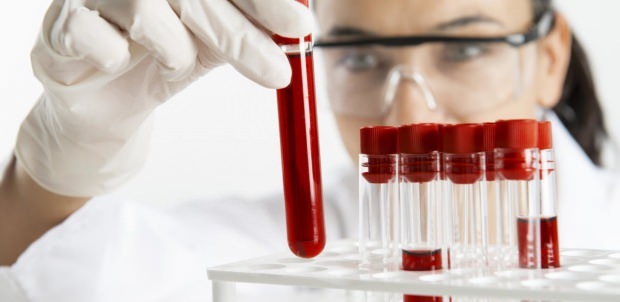 रक्त परीक्षण द्वारा हीमोग्लोबिन स्तर की जाँच की जाती है