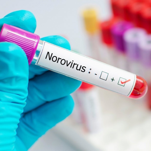 नोरोवायरस क्या है और यह किन बीमारियों का कारण बनता है? नोरोवायरस संक्रमण के बारे में अज्ञात ...
