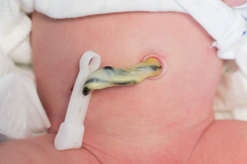 शिशुओं में गर्भनाल कब गिरती है?