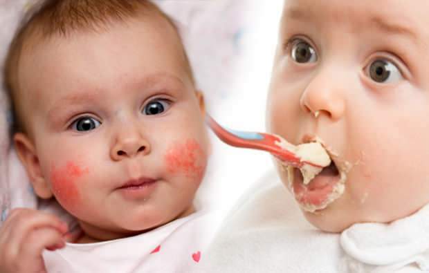 शिशुओं में एलर्जी के लक्षण
