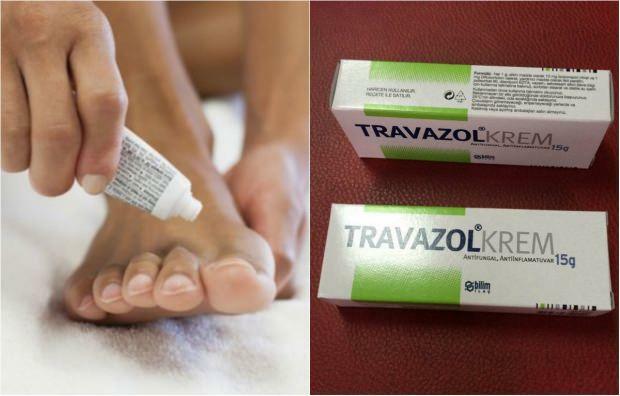 Travazol क्रीम क्या करता है? Traumol क्रीम का उपयोग कैसे किया जाता है? Travazol क्रीम की कीमत