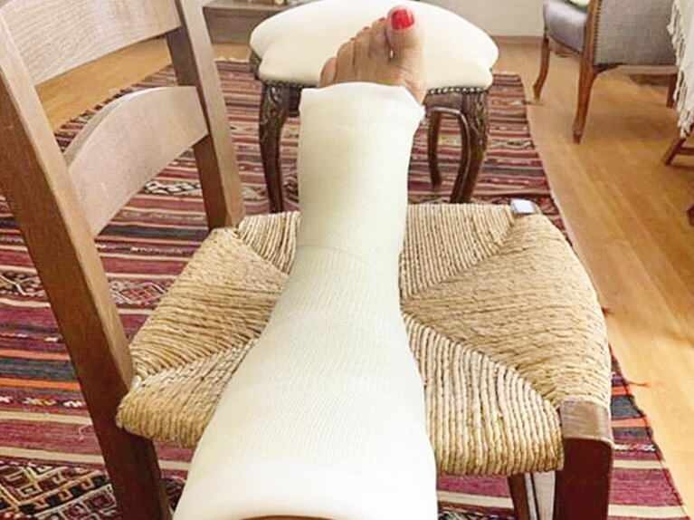 मास्टर कलाकार आयस कोंक ने अपना पैर तोड़ दिया