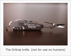 यह DrSnip Pocketknife का स्क्रीनशॉट है। जे बेयर का कहना है कि चाकू एक बात ट्रिगर का एक उदाहरण है।