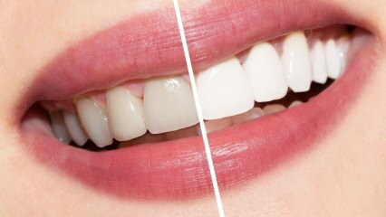 सफेद दांतों के लिए क्या सिफारिशें हैं? घर पर प्राकृतिक रूप से दांतों का सफेद होना ...