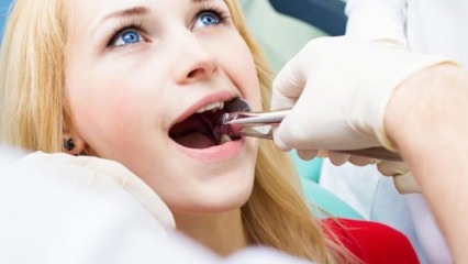 क्या गर्भावस्था के दौरान दांत निकालना है?