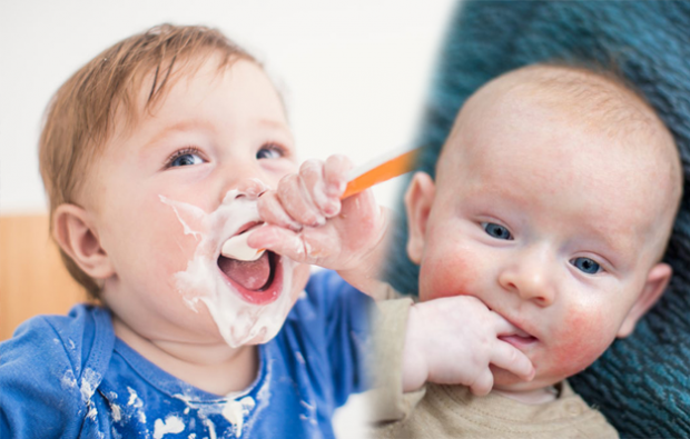 शिशुओं में खाद्य एलर्जी के लक्षण