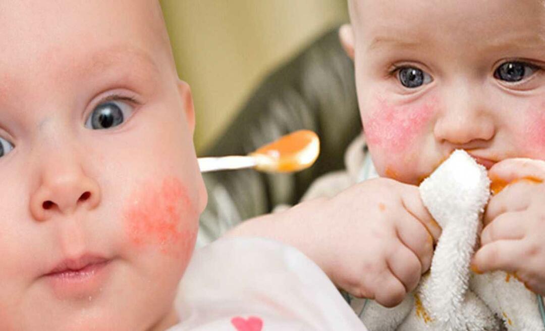 एलर्जी वाले बच्चे को क्या खाना चाहिए? एलर्जी वाले शिशुओं के लिए वैकल्पिक खाद्य पदार्थ क्या हैं?
