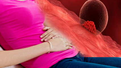 गर्भावस्था के दौरान रक्तस्राव क्या है? आरोपण रक्तस्राव और मासिक धर्म रक्तस्राव के बीच अंतर कैसे करें